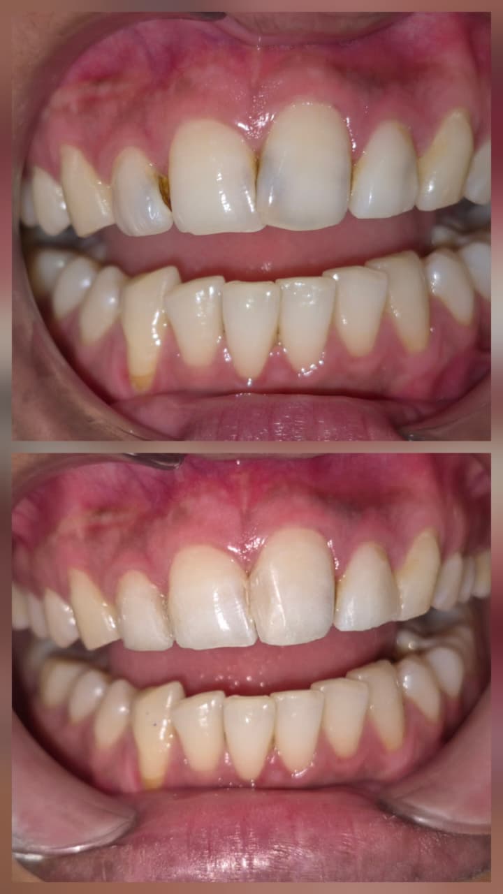 Before and after smile transformation 7